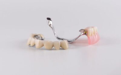 Come scegliere la protesi dentale più naturale: materiali e tecniche estetiche