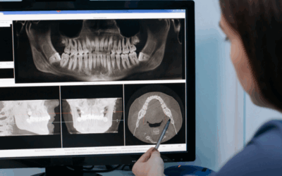 Si possono richiedere le radiografie al dentista?