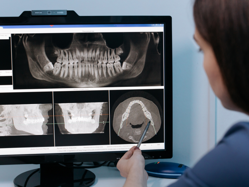 Si possono richiedere le radiografie al dentista?