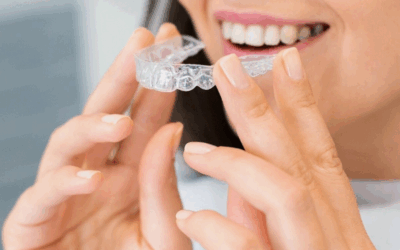 Come raddrizzare i denti senza apparecchio