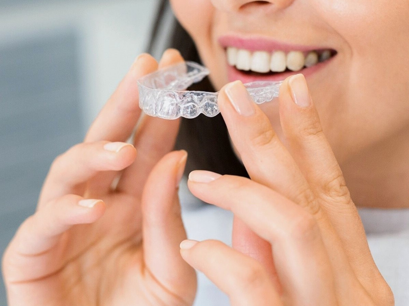 Come raddrizzare i denti senza apparecchio