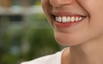 Come stringere i denti davanti senza apparecchio