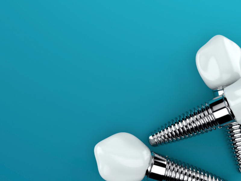 Quanti tipi di impianti dentali esistono?